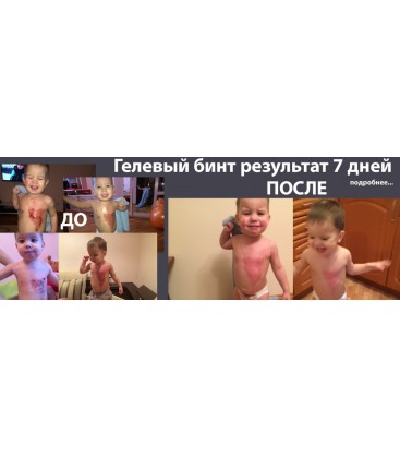 Zentex - гелевый бинт 